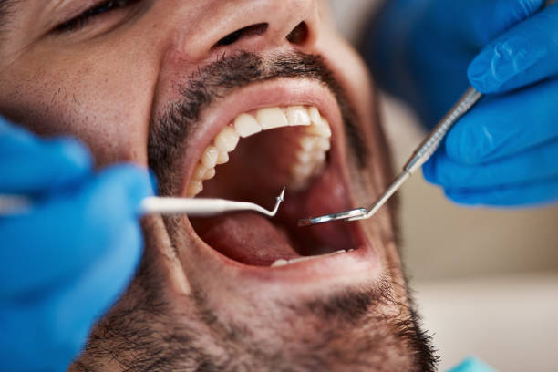Best Urgent Tooth Repair  in Huachuca City, AZ